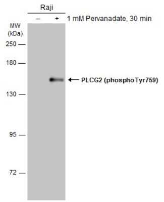 Western Blot: PLC-gamma 2 [p Tyr759] Antibody [NBP3-13241] - Untreated (-) and treated (+) Raji whole cell extracts (10 ug) were separated by 7.5% SDS-PAGE, and the membrane was blotted with PLC-gamma 2 (phospho Tyr759) antibody (NBP3-13241) diluted at 1:1000. The HRP-conjugated anti-rabbit IgG antibody (NBP2-19301) was used to detect the primary antibody.